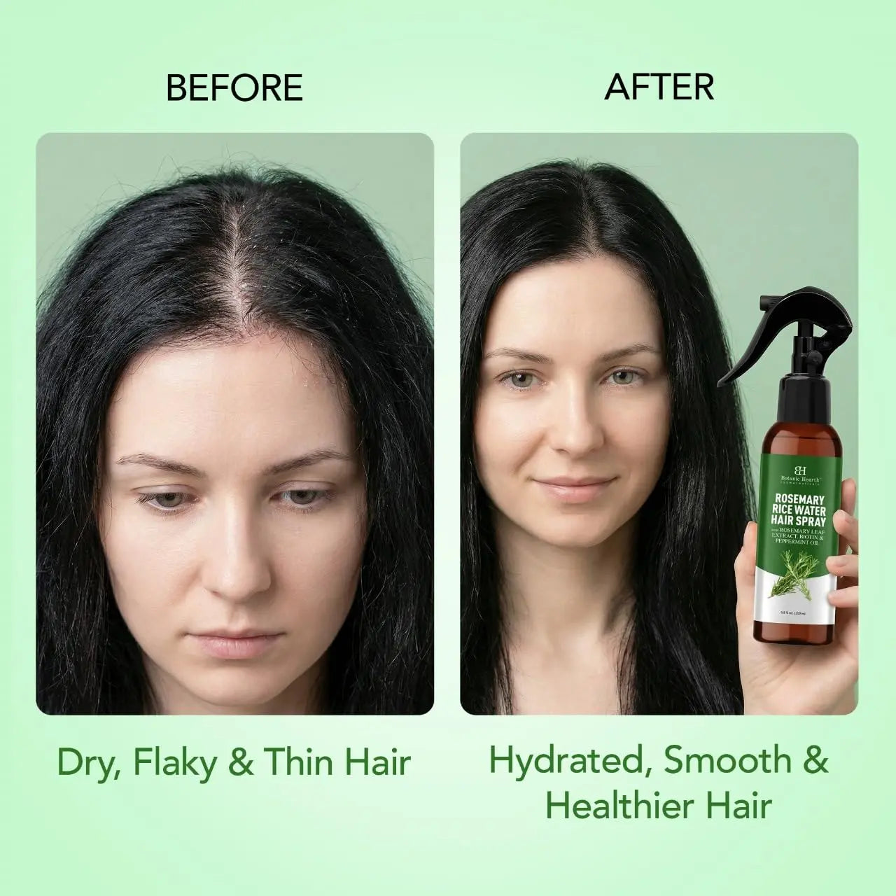 Botanic Hearth Rosemary Hair Growth Water Spray 6.8 fl oz, Korean Hair Care Oil for Scalp Detox, Hydration for Thinning Hair | Anti-Itch, Anti-Flake, Sulfate & Paraben Free Ifelshop