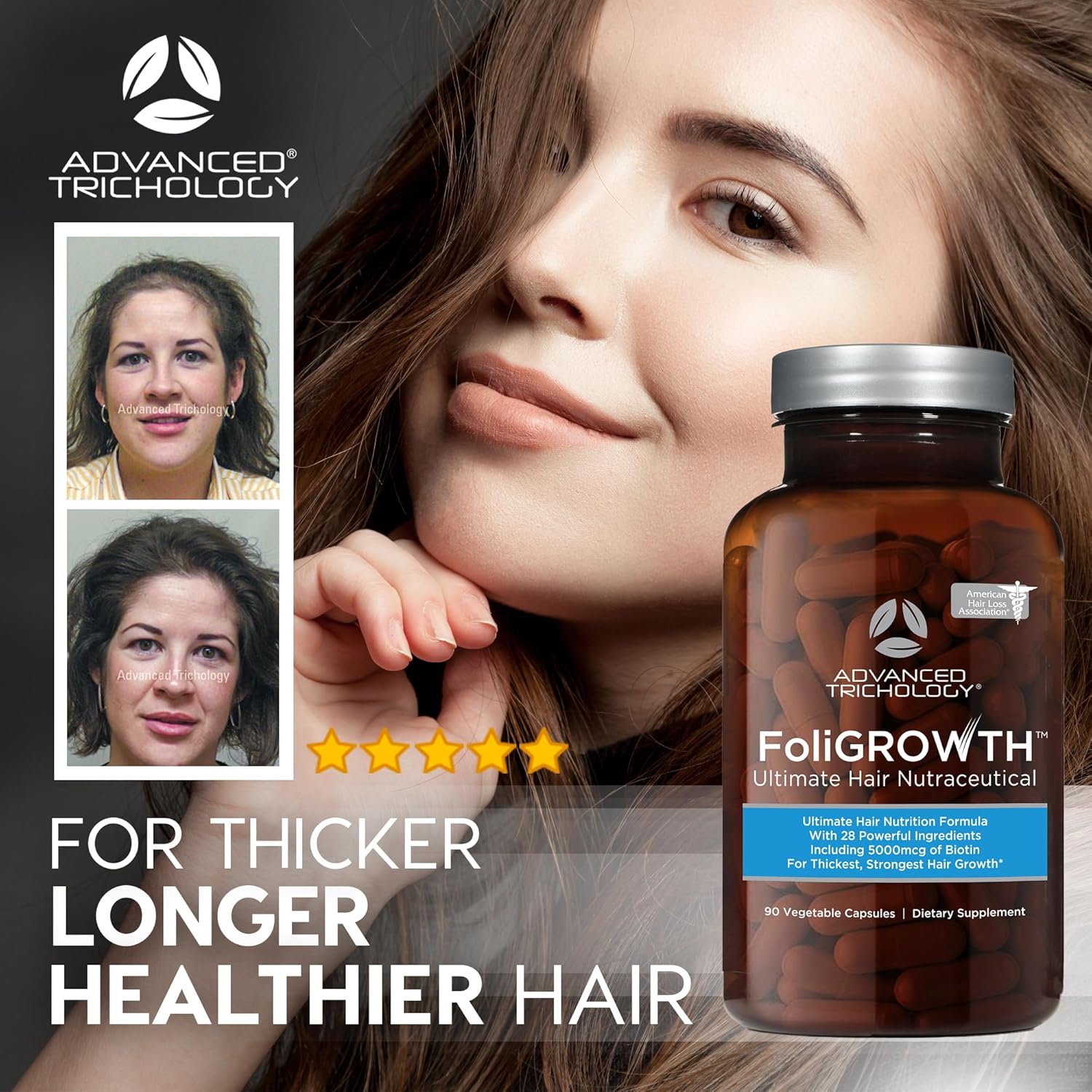 Advanced Trichology FoliGROWTH Hair Growth Supplement – Daily Nutritional Support for Thicker, Fuller-Looking Hair, Backed by Hair Loss Experts (90 Capsules) IFELSHOP