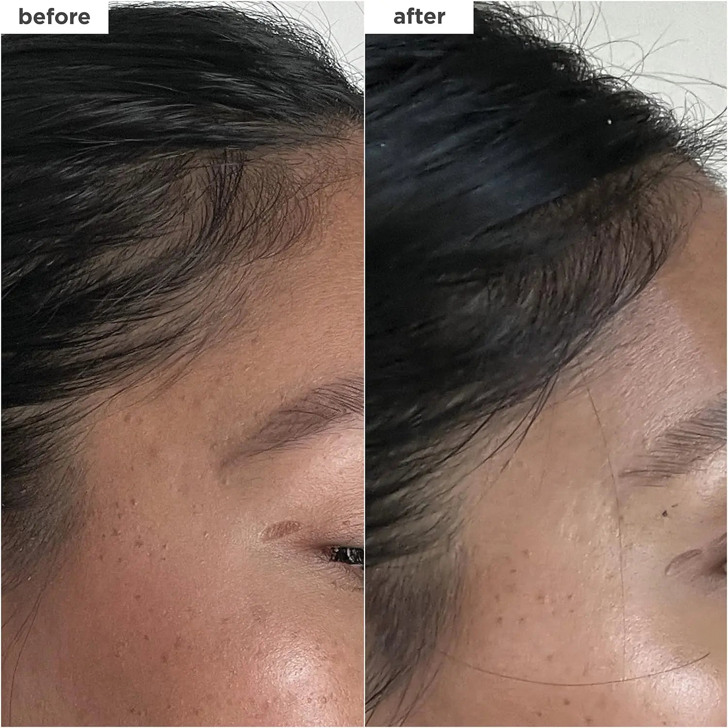 Briogeo Destined For Density MegaStrength+ Peptide Density Serum – Fast-Absorbing, Non-Greasy, Increases Hair Thickness & Volume, Fragrance-Free, Vegan & Cruelty-Free, 1.5 fl oz Ifelshop