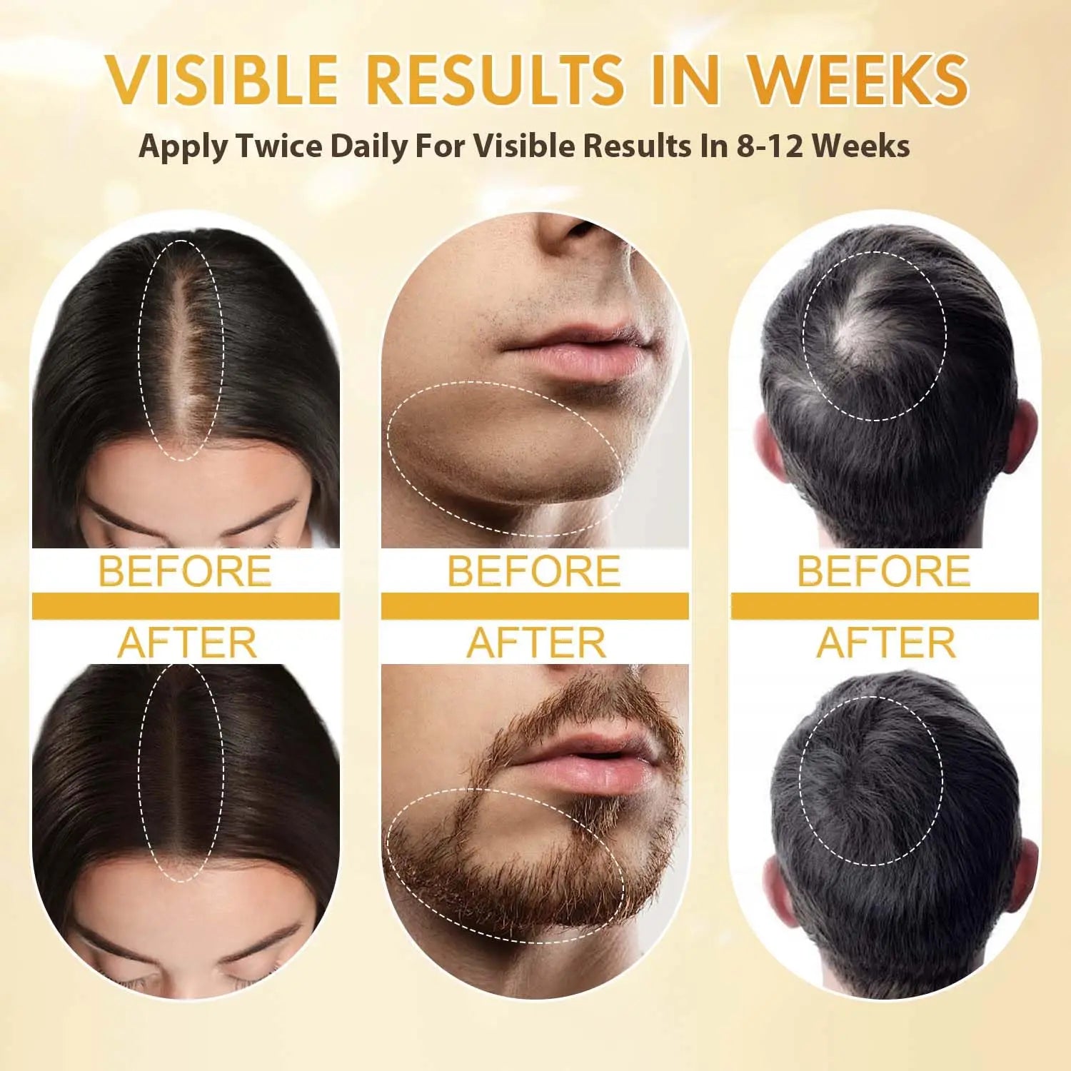 Minoxidil for Men and Women, Hair Growth Biotin Serum with Batana and Rosemary for Hair Beard Regrowth Treatments Extra Strength Hair Loss Solution, Clinically Proven to Regrow Thicker Ifelshop