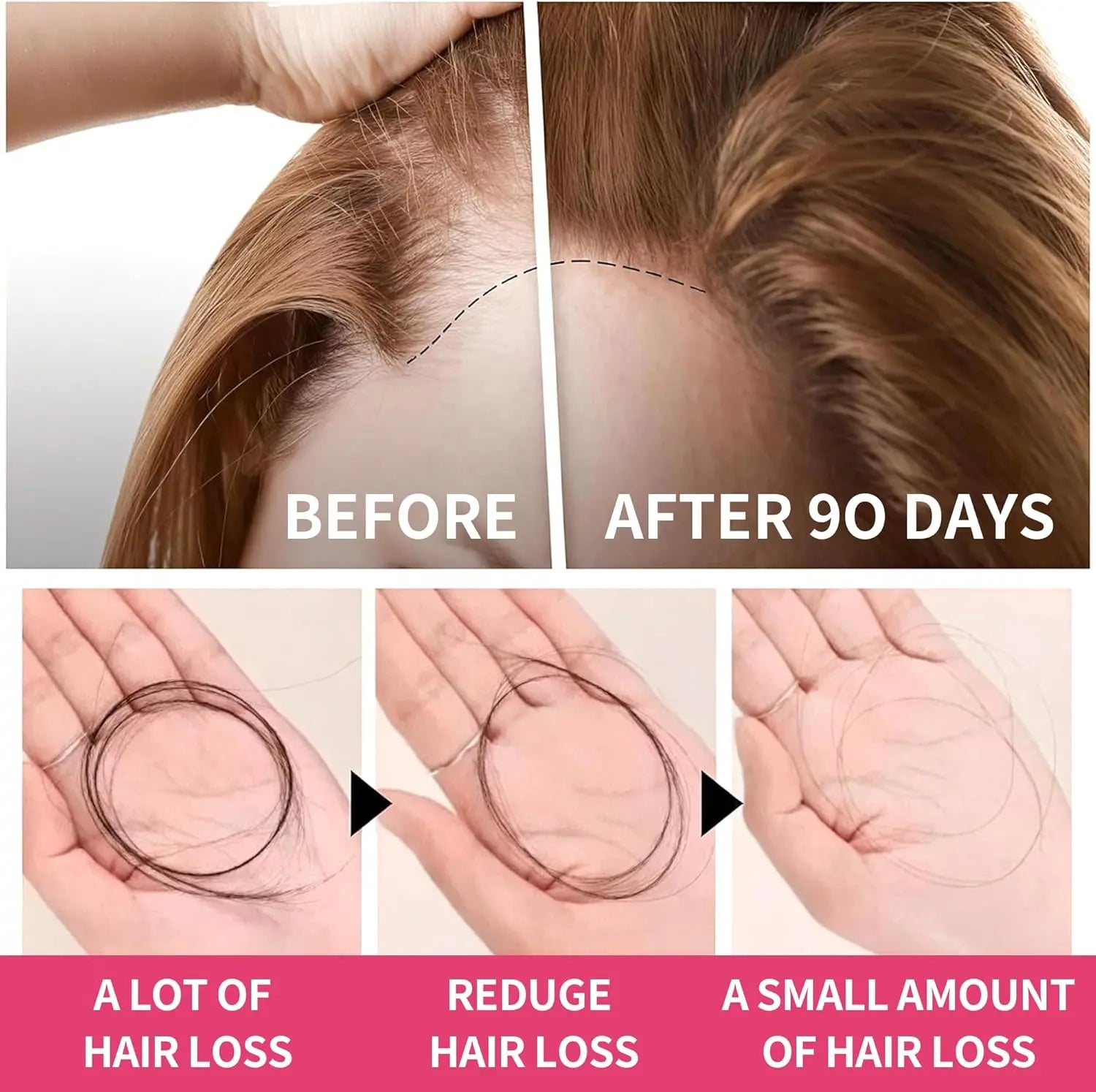 Women's Hair Growth Accelerator Supplement Gummies, Nourishes Thinning Hair & Boosts Hair Thickness, With Collagen, Biotin, Zinc, Vitamin C & Iron – Pineapple Flavor – 90 Gummies, 45 Day Supply Ifelshop