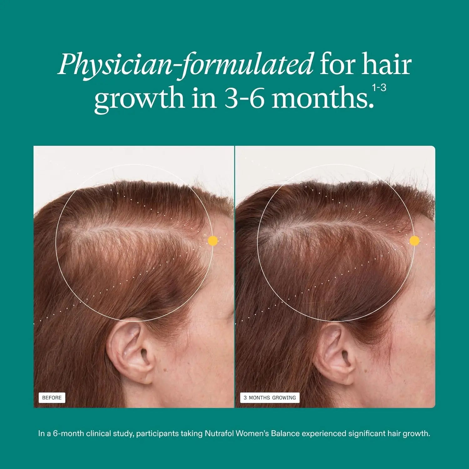 Nutrafol Women’s Balance Hair Growth Supplements – Hormone-Targeted Formula for Women 45+, Supports Thicker Hair - 2 Month Supply, 2 Refill Pouches Ifelshop