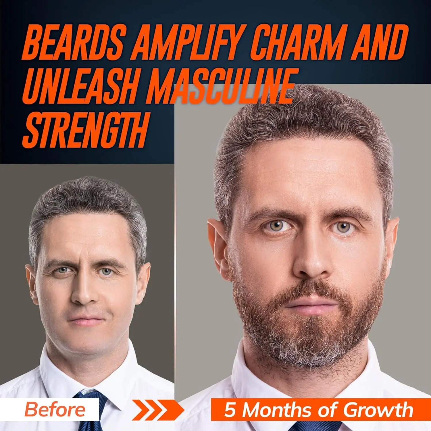 5% Minoxidil Beard Growth Serum for Men: Hair Regrowth Spray with Biotin & Rice Water - Extra Strength Beard Oil for Faster Thicker and Fuller Beard Growth - 60ML Ifelshop