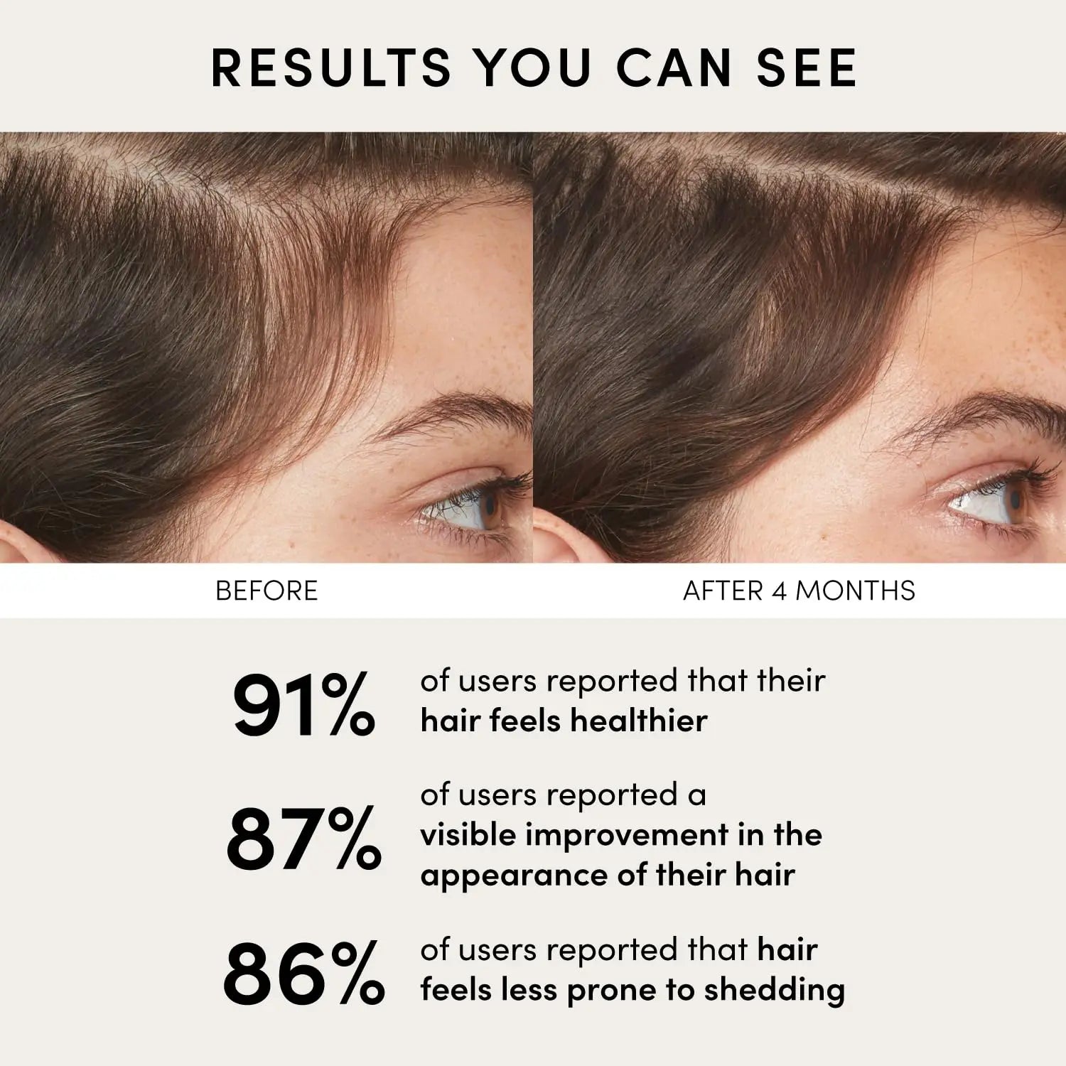 OUAI Scalp Balancing Serum – Lightweight Peptide Scalp Treatment with Red Clover Extract & Siberian Ginseng for Fuller-Looking Hair, Clean & Sulfate-Free Formula (2 fl oz) Ifelshop