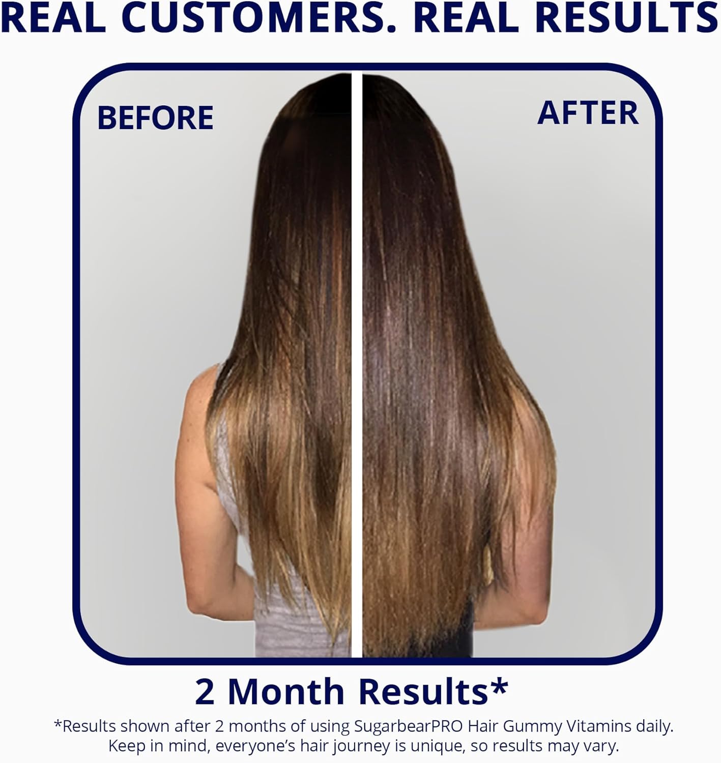 Sugarbear Hair Vitamin Gummy 2 Month Supply Extra Strength Biotin 6000mcg, Growth for Men & Women, Vegan Vitamin B12, MSM, Inositol, Omega 3, Elderberry, Certified Kosher, Halal, Cruelty-Free Ifelshop