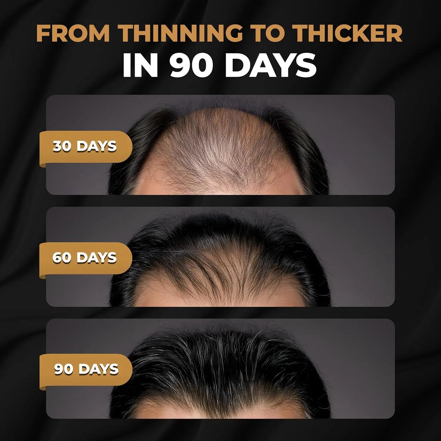 SPARTAN™ Root Activator Shampoo For Men - Hair Growth Shampoo for Hair Loss and Thinning Hair Ifelshop