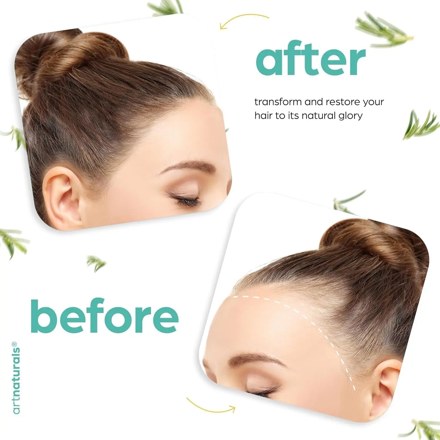 Artnaturals Organic Rosemary Castor Hair Oil + Massager Hair Growth Set Hair Growth Oil 4 ounces with Coconut & Olive Oil for Dry, Damaged & Split End IFELSHOP