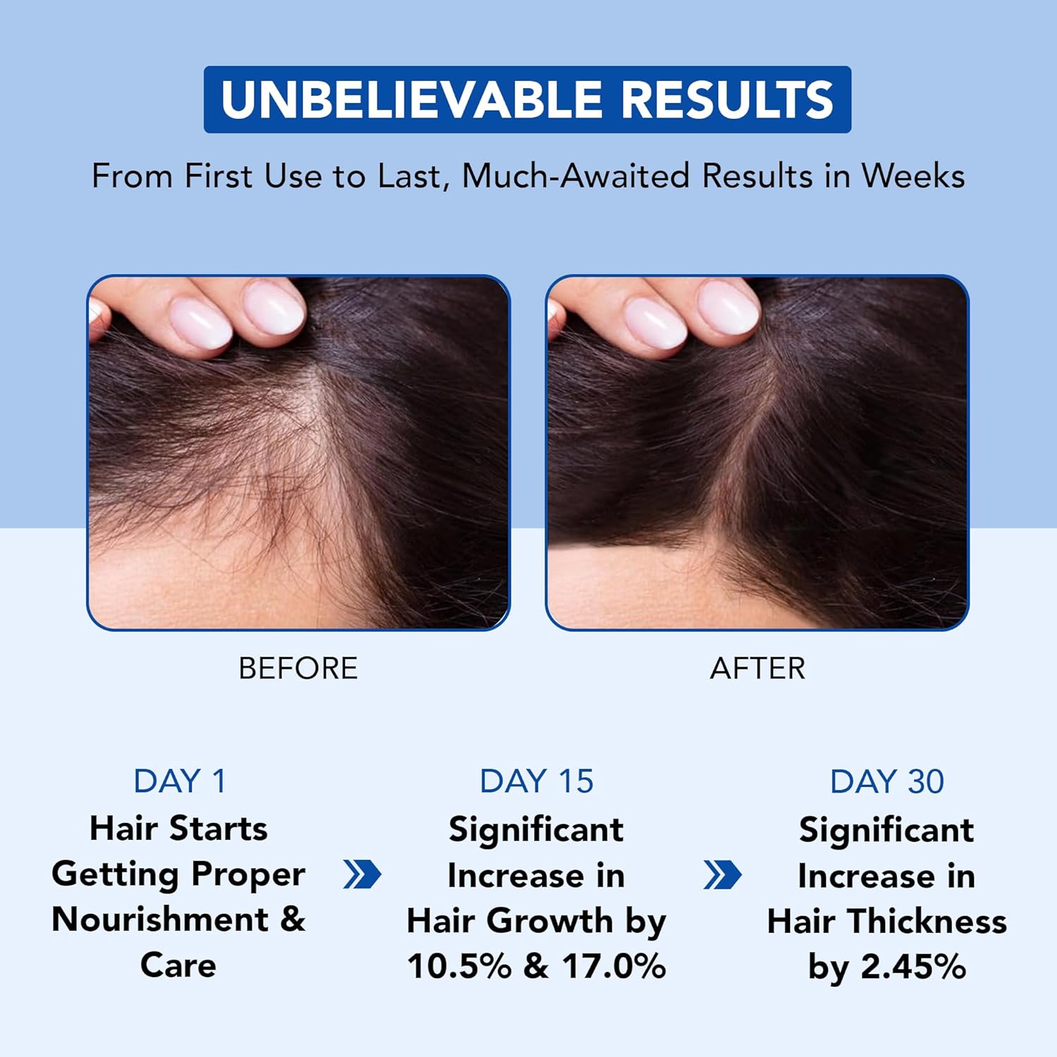 Botanic Hearth 100% Pure Rosemary Oil for Hair Growth (6.7 fl oz)| Infused with Biotin, Jojoba & Castor Oil IFELSHOP