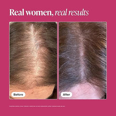 Viviscal Hair Growth Supplements for Women, Thicker Fuller Hair Support for Thinning Hair and Hair Loss, with Biotin and Marine Collagen, Drug-Free, 180 Tablets, 90-Day Supply