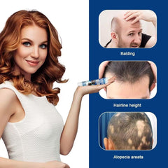 Alopecia Hair Growth Cream Herbal Scalp Care for Strong Hair Roots and Fuller Hair Regrowth Ifelshop