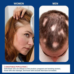 Alopecia Hair Growth Cream Herbal Scalp Care for Strong Hair Roots and Fuller Hair Regrowth Ifelshop