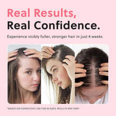 ForChics Hair Growth Serum for Women- Results in 4 Weeks- Hormone Free Hair Regrowth Treatment - For Thinning Hair Loss - Fast Absorbing Non-Greasy Scalp Spray 50ml Ifelshop