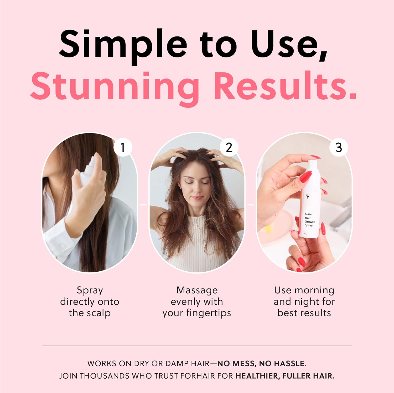 ForChics Hair Growth Serum for Women- Results in 4 Weeks- Hormone Free Hair Regrowth Treatment - For Thinning Hair Loss - Fast Absorbing Non-Greasy Scalp Spray 50ml Ifelshop