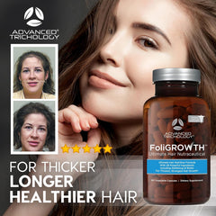 Advanced Trichology FoliGROWTH Hair Growth Supplement – Daily Nutritional Support for Thicker, Fuller-Looking Hair, Backed by Hair Loss Experts (90 Capsules) IFELSHOP