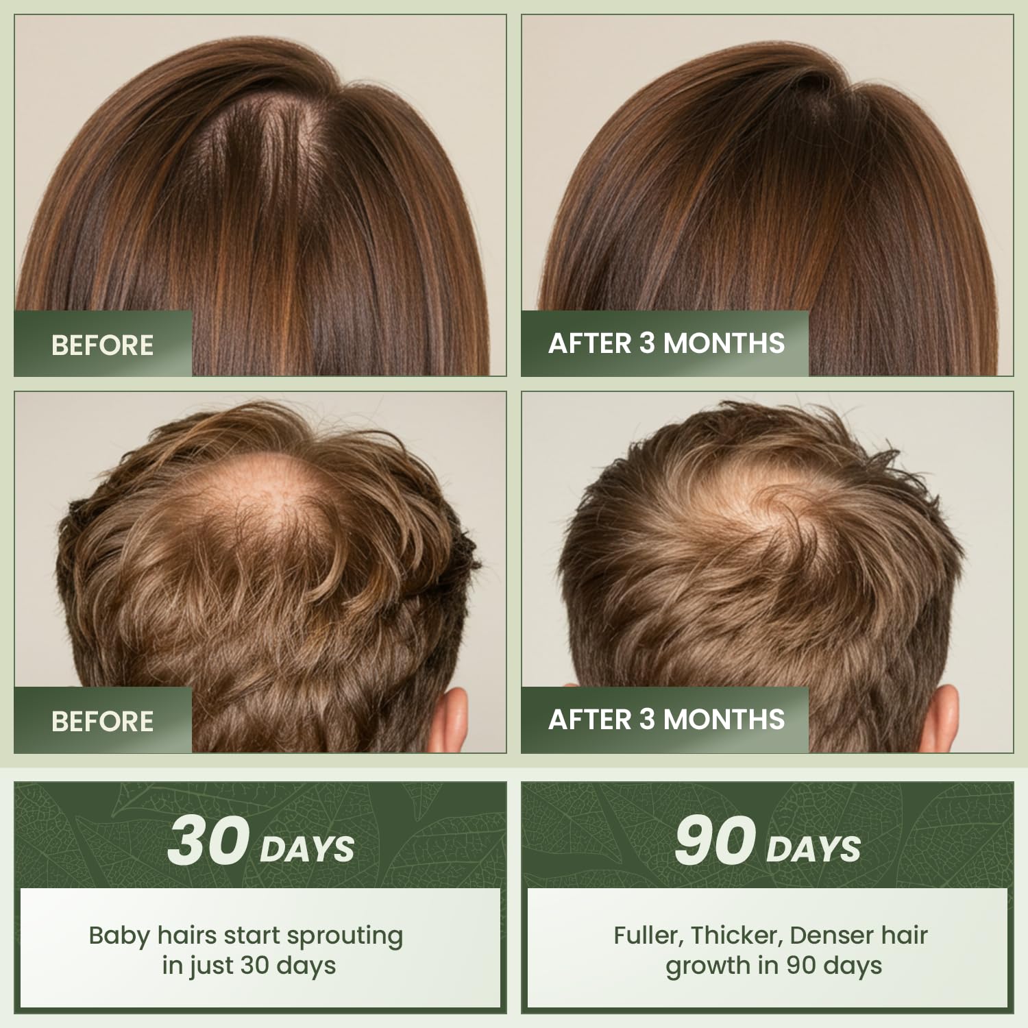 Essynaturals Hair Growth Oil with Biotin - Caffeine and Castor Oil for Fuller, Thicker, Longer Hair IFELSHOP