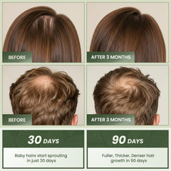 Essynaturals Hair Growth Oil with Biotin - Caffeine and Castor Oil for Fuller, Thicker, Longer Hair IFELSHOP