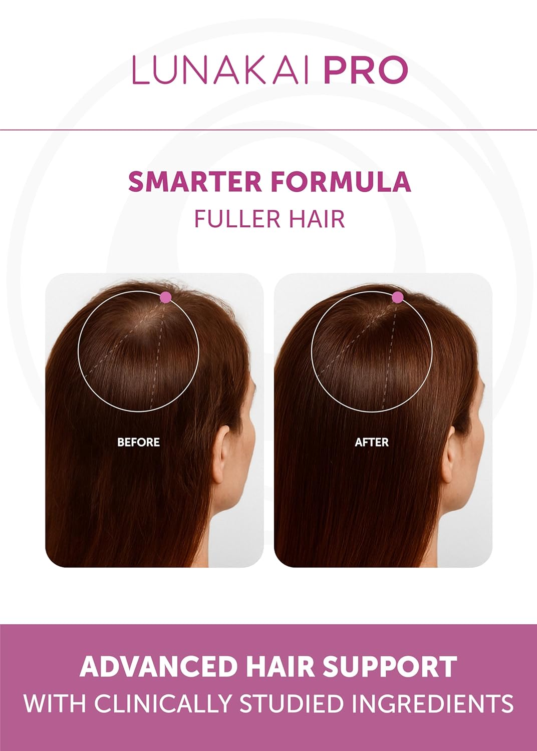 Lunakai PRO Women’s Hair Growth & Restore Vitamins – Advanced 15+ Nutrient Formula to Support Thicker, Stronger Hair, USA Made Hair Supplement (90 Capsules) IFELSHOP