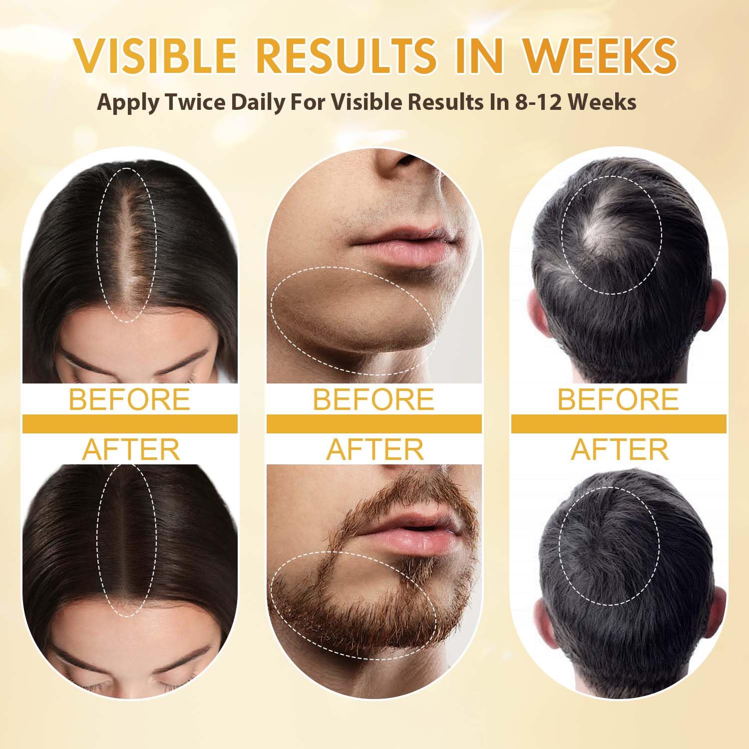 Minoxidil for Men and Women, Hair Growth Biotin Serum with Batana and Rosemary for Hair Beard Regrowth Treatments Extra Strength Hair Loss Solution, Clinically Proven to Regrow Thicker Ifelshop