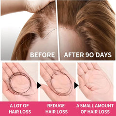 Women's Hair Growth Accelerator Supplement Gummies, Nourishes Thinning Hair & Boosts Hair Thickness, With Collagen, Biotin, Zinc, Vitamin C & Iron – Pineapple Flavor – 90 Gummies, 45 Day Supply Ifelshop