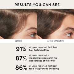 OUAI Scalp Balancing Serum – Lightweight Peptide Scalp Treatment with Red Clover Extract & Siberian Ginseng for Fuller-Looking Hair, Clean & Sulfate-Free Formula (2 fl oz) Ifelshop