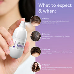 W-Regrow Pro Hair Growth Spray - with Biotin, Rosemary, Caffeine, Copper Peptide, Niacinamide, Hair Growth Products for Men Women, Non-Greasy Scalp Serum for Hair Thinning & Hair Loss Ifelshop