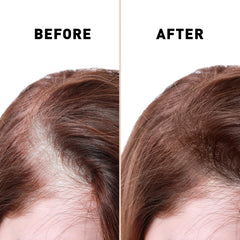 Bald Spot Hair Growth Cream Scalp Treatment for Receding Hair for Men and Women Just Nutritive 4 Oz Ifelshop