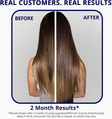 Sugarbear Hair Vitamin Gummy 2 Month Supply Extra Strength Biotin 6000mcg, Growth for Men & Women, Vegan Vitamin B12, MSM, Inositol, Omega 3, Elderberry, Certified Kosher, Halal, Cruelty-Free Ifelshop