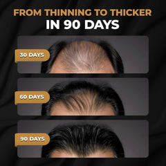 SPARTAN™ Root Activator Shampoo For Men - Hair Growth Shampoo for Hair Loss and Thinning Hair Ifelshop