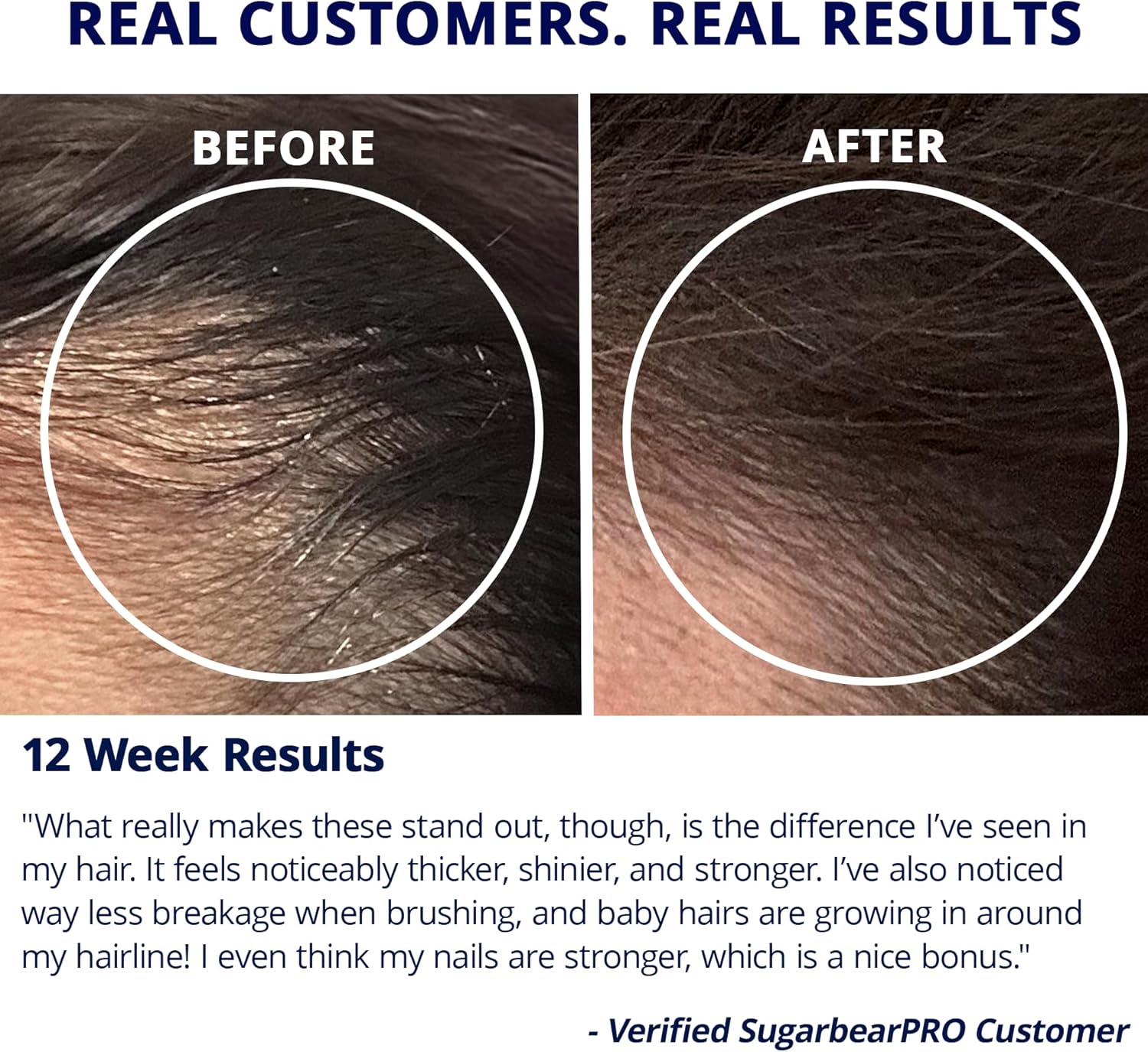 Sugarbear Hair Vitamin Gummy 2 Month Supply Extra Strength Biotin 6000mcg, Growth for Men & Women, Vegan Vitamin B12, MSM, Inositol, Omega 3, Elderberry, Certified Kosher, Halal, Cruelty-Free Ifelshop