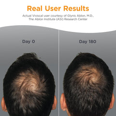 Viviscal Men’s Hair Growth Supplements – Clinically Proven Collagen Complex to Support Thicker, Fuller-Looking Hair, 3-Month Supply (180 Tablets) Ifelshop